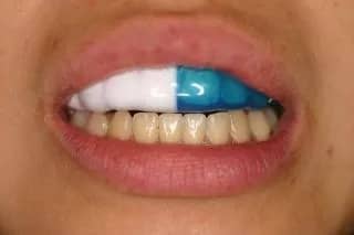 スポーツガード​