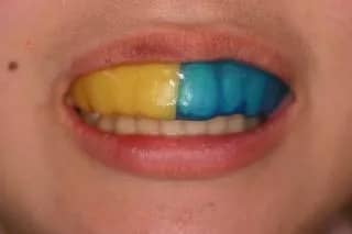 スポーツガード​