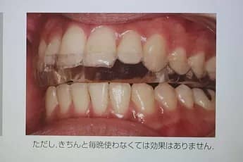 ただし、きちんと毎晩使わなくては効果はありません。